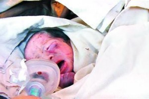 태어나자마자 변기통에 버려진 中아기 생명 위독